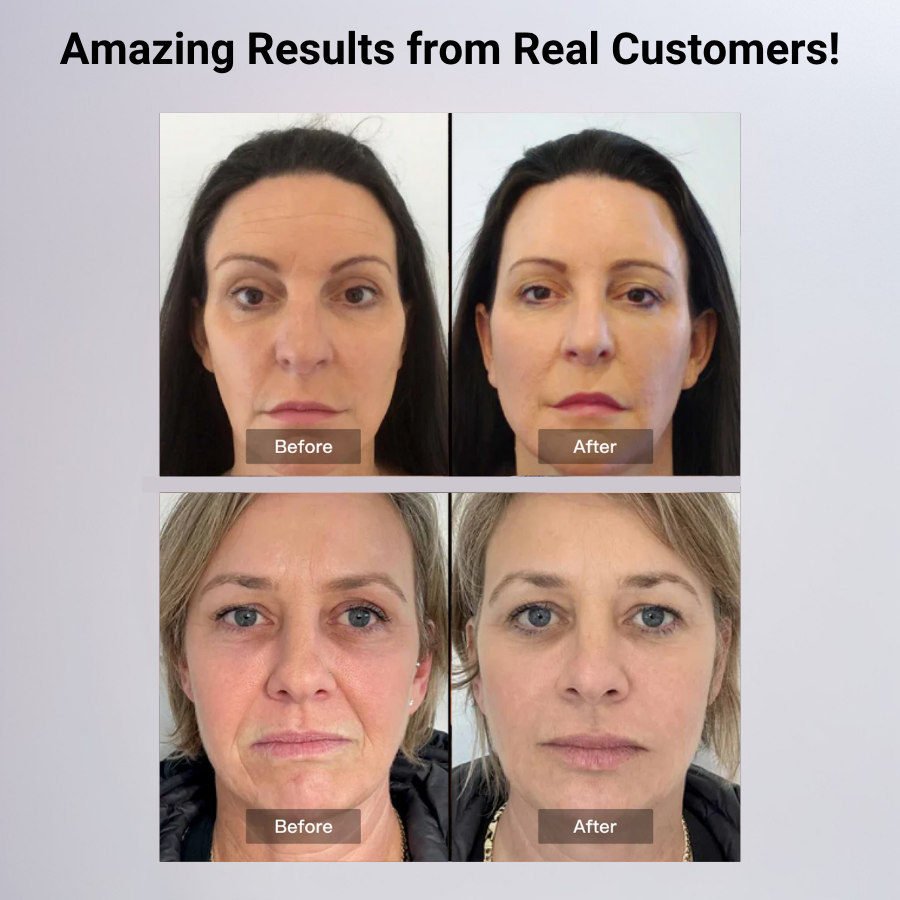 Vantelle LivYoung Face Mask