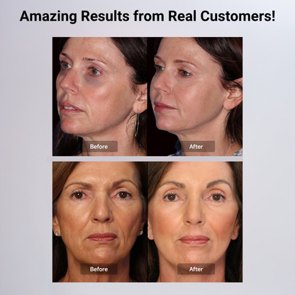 Vantelle LivYoung Face Mask